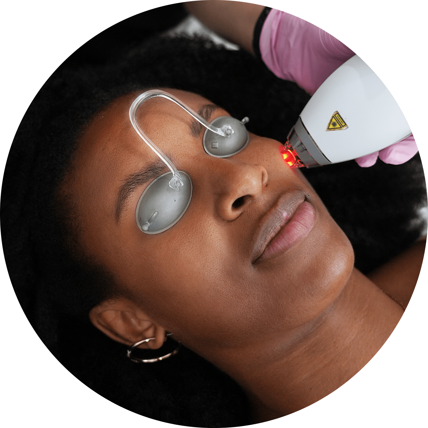 Clear + Brilliant® Laser Facial treatment area